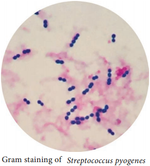 Streptococcus pyogenes (Flesh eating Bacteria) img 1
