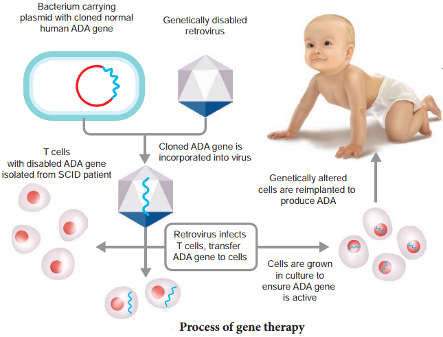 Biotechnology Of Gene Therapy img 1